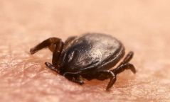 Хачигт халдварын өвчлөлийн сэжигтэй нийт 24 хүн иржээ