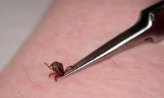 Хачгаар дамжих халдварт өвчний нэг тохиолдол бүртгэгджээ