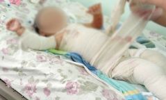 АНХААР: Хоёр настай хүүхэд буцалж байсан шөлөнд түлэгджээ