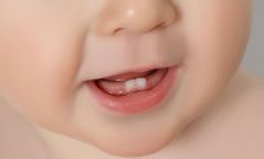 “Эрүүл шүд-Эрүүл хүүхэд “ хөтөлбөр хэрэгжиж эхэллээ